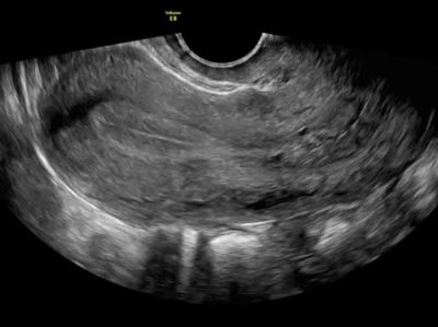 ecografia-ginecologica-medical-imaging